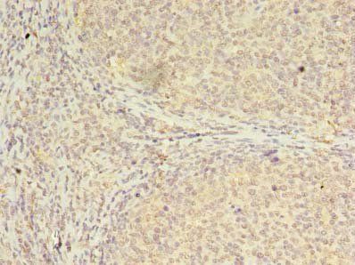 CBX2 Antibody
