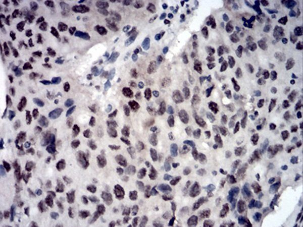 CBX3 Antibody