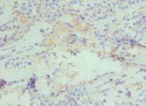 CBX4 Antibody