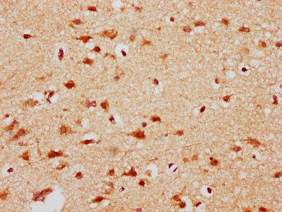 CBX4 Antibody