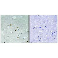 CBX5 (Ab-92) antibody