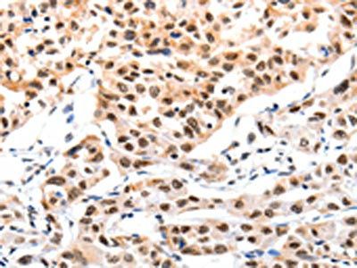 CBX8 Antibody