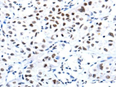 CBX8 Antibody
