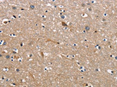 CBY1 Antibody