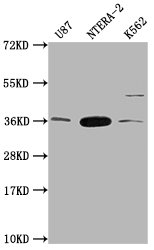 CBY1 antibody