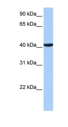 CC2D1B antibody