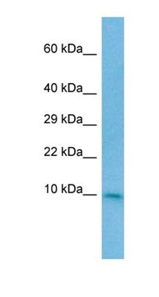 CC2D2A antibody