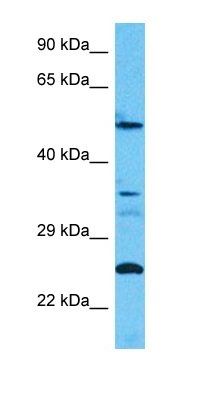 CC2D2B antibody