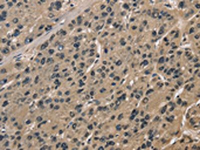 CCAR1 Antibody