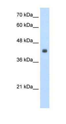 CCBL2 antibody