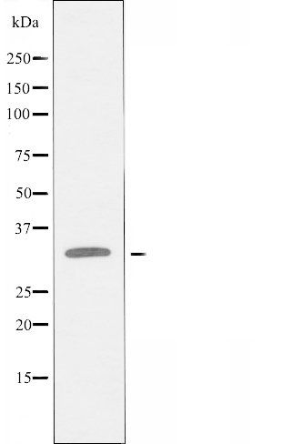 CCBP2 antibody