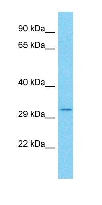 CCDC101 antibody