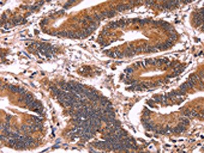 CCDC106 Antibody