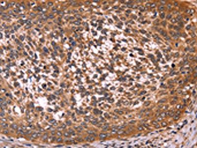 CCDC106 antibody