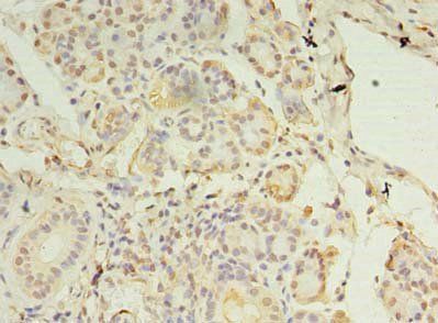 MCUB Antibody