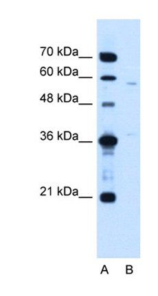 CCDC112 antibody