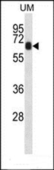 CCDC120 antibody