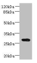 CCDC127 antibody