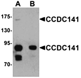 CCDC141 Antibody