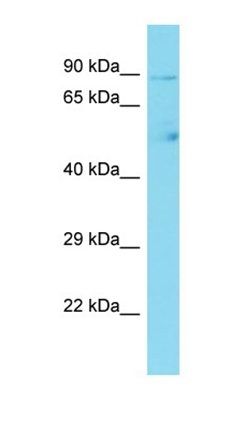 CCDC142 antibody