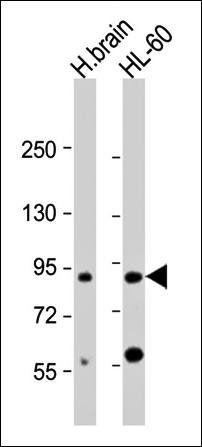 CCDC144A antibody