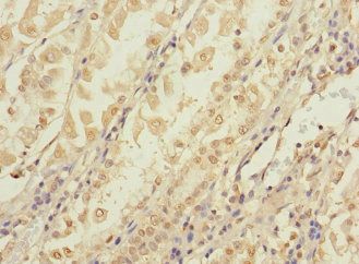 CCDC150 Antibody