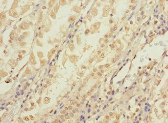 CCDC150 antibody