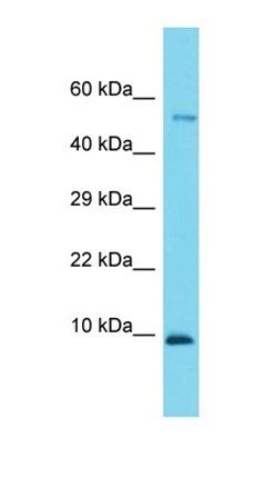 Ccdc167 antibody