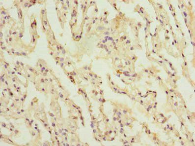 CCDC181 Antibody