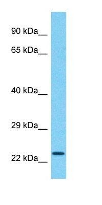 CCDC183 antibody