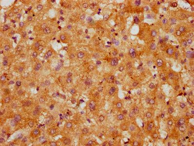 CCDC28B Antibody