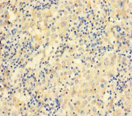 CCDC36 Antibody