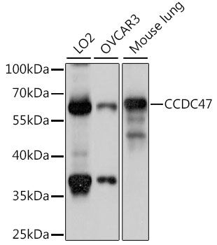 CCDC47 antibody