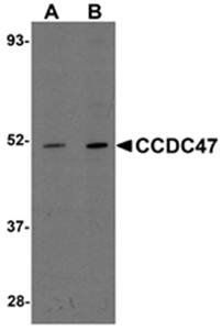 CCDC47 Antibody
