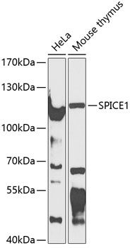 CCDC52 antibody