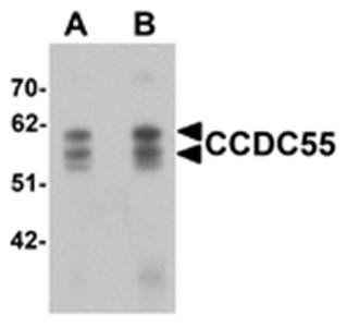 CCDC55 Antibody