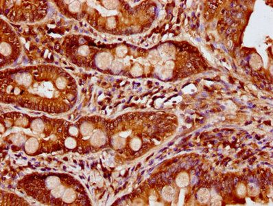 CCDC6 Antibody