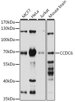 CCDC6 antibody