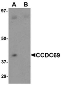 CCDC69 Antibody