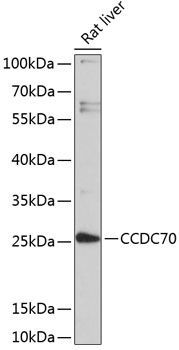 CCDC70 antibody