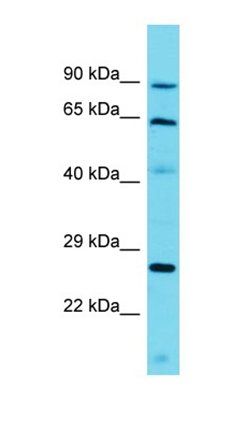 CCDC79 antibody