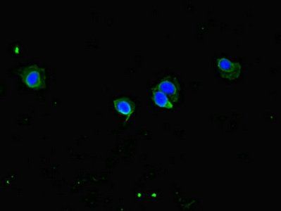 CCDC8 Antibody