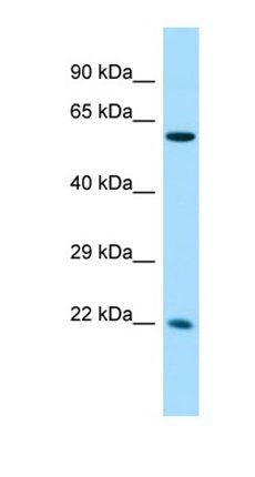 CCDC85A antibody