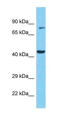 CCDC85C antibody