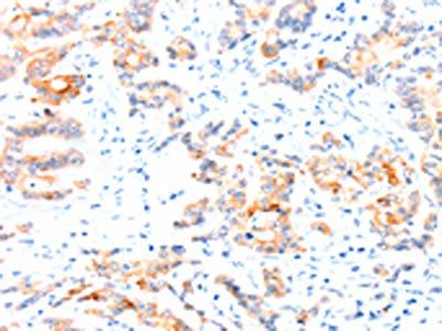 CCDC88A antibody