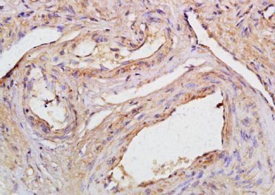 CCDC90A Rabbit Polyclonal Antibody