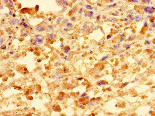 CCDC91 antibody