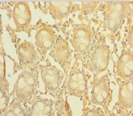CCDC94 Antibody