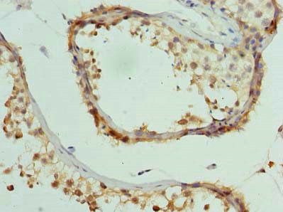 CCDC97 Antibody