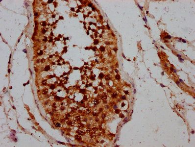 CCIN Antibody